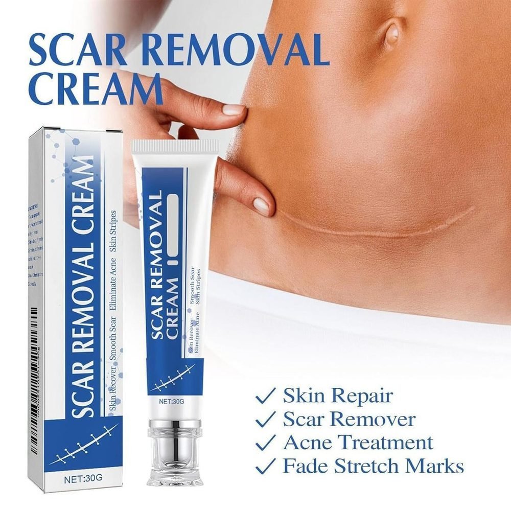 ekd 0258 scar removal cream ekd 0258 scar removal cream